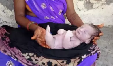 Woman gives birth to a baby that looks like a fish in Pilibhit